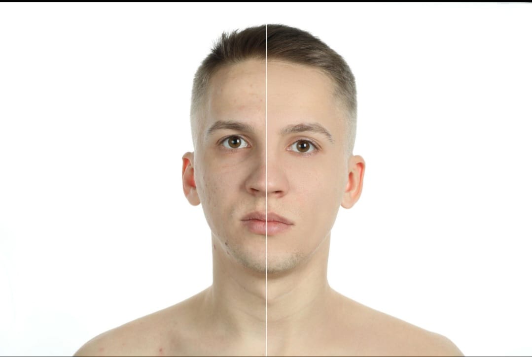 Best Skin Care Samples 2026: Ultimate Free Guide META